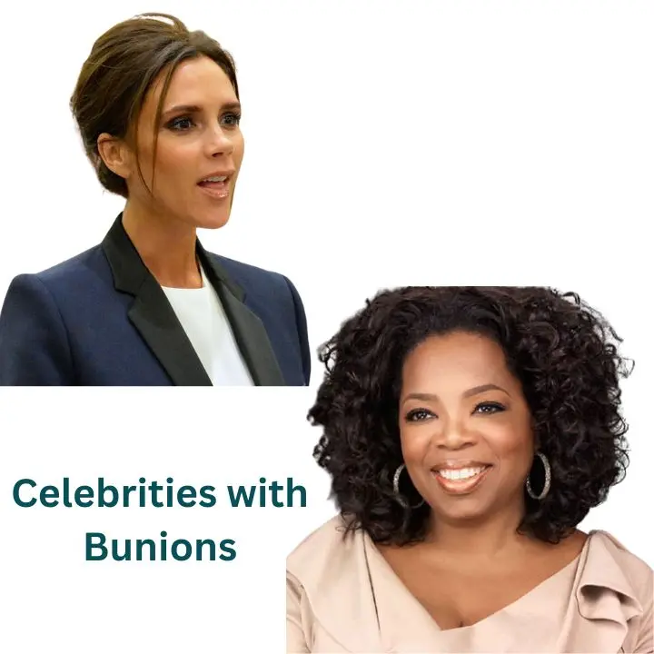 Celebrities with Bunions: List of 2024