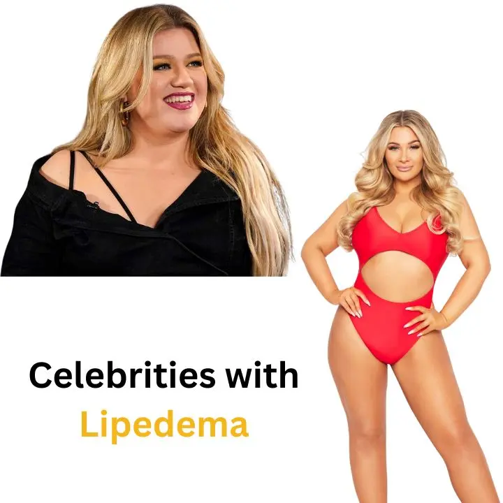 Celebrities with Lipedema: All Celebrities List