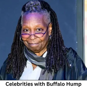 Celebrities with Buffalo Hump